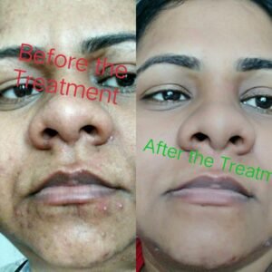 Kavita's Beauty Care Malad East Mumbai